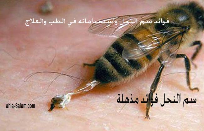 فوائد سم النحل واستخداماته في الطب والعلاج