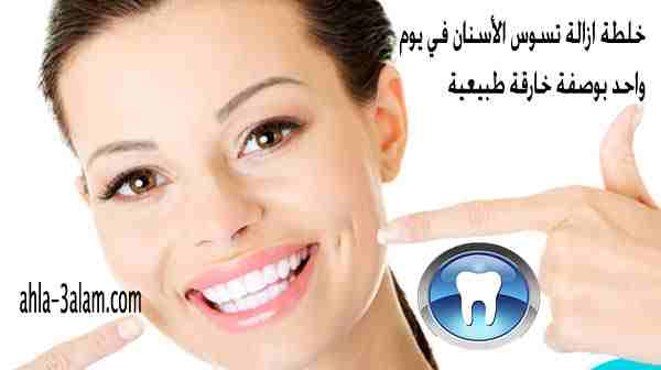 خلطة ازالة تسوس الأسنان وتبييضها في يوم واحد بوصفة خارقة طبيعية