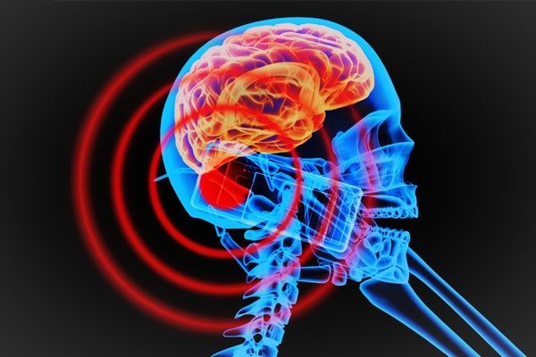 هل الأجهزة الذكية تسبب سرطان الدماغ