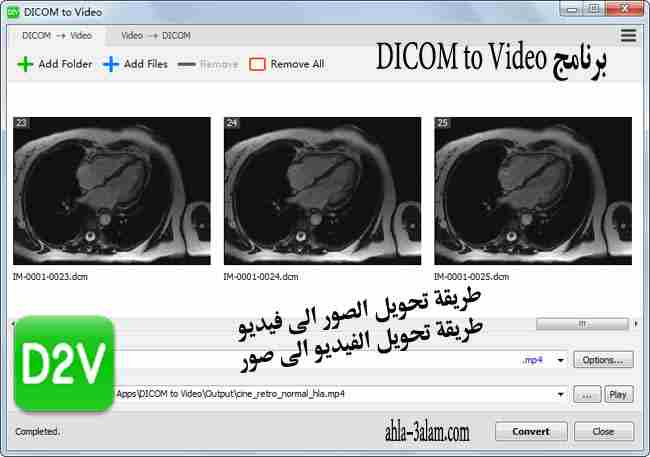 طريقة تحويل الصور الى فيديو والعكس بسهولة برنامج DICOM to Video
